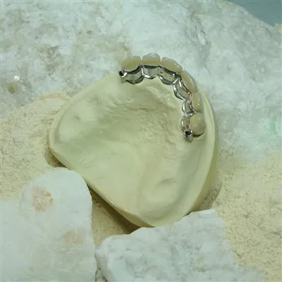 Gipsum Gigi Tipe IV - Kecepatan Marmorock®